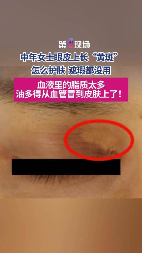 吉布斯-怀特入选英格兰名单：超越梅努的潜力解析